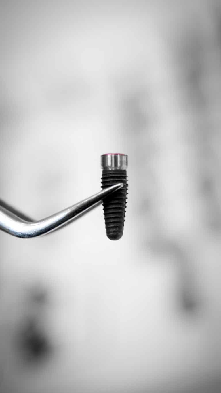 Implante dental de titanio sujeto con unas pinzas