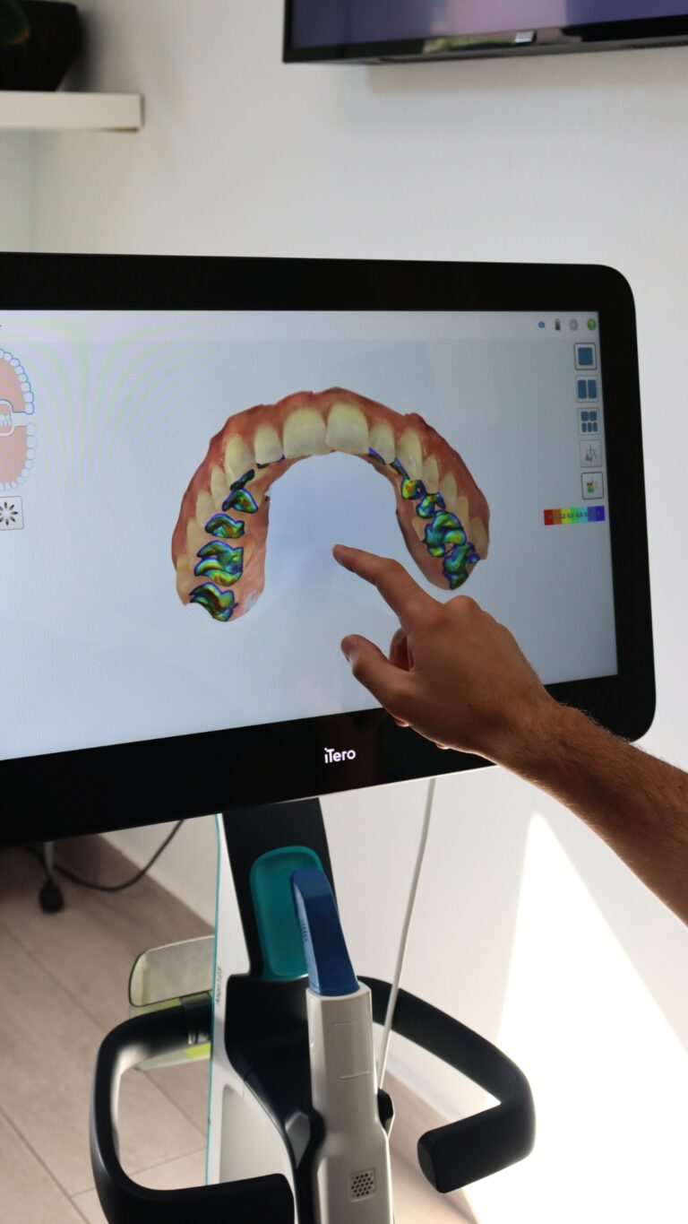 Pantalla con el modelo digital de una arcada dental y un escáner intraoral
