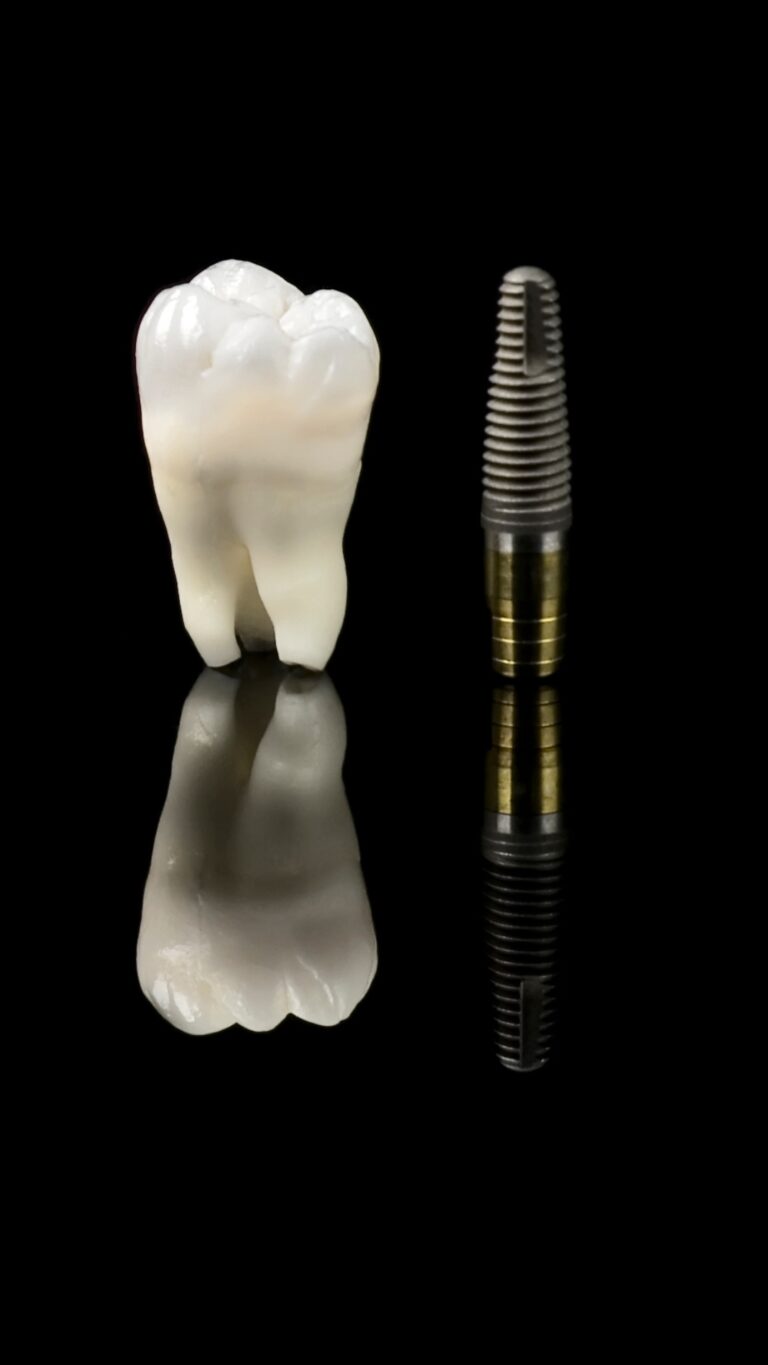 Muela natural junto a un implante dental de titanio