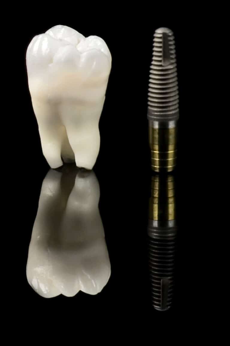 Implante dental junto a una muela